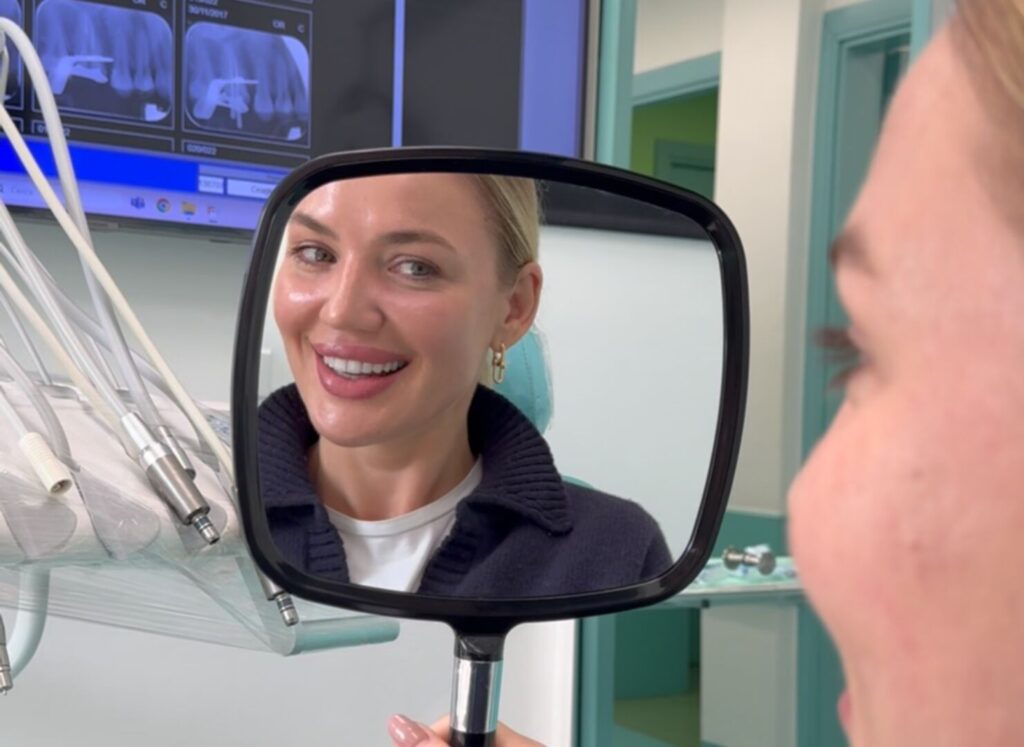 Come cambiano i denti con le faccette dentali
