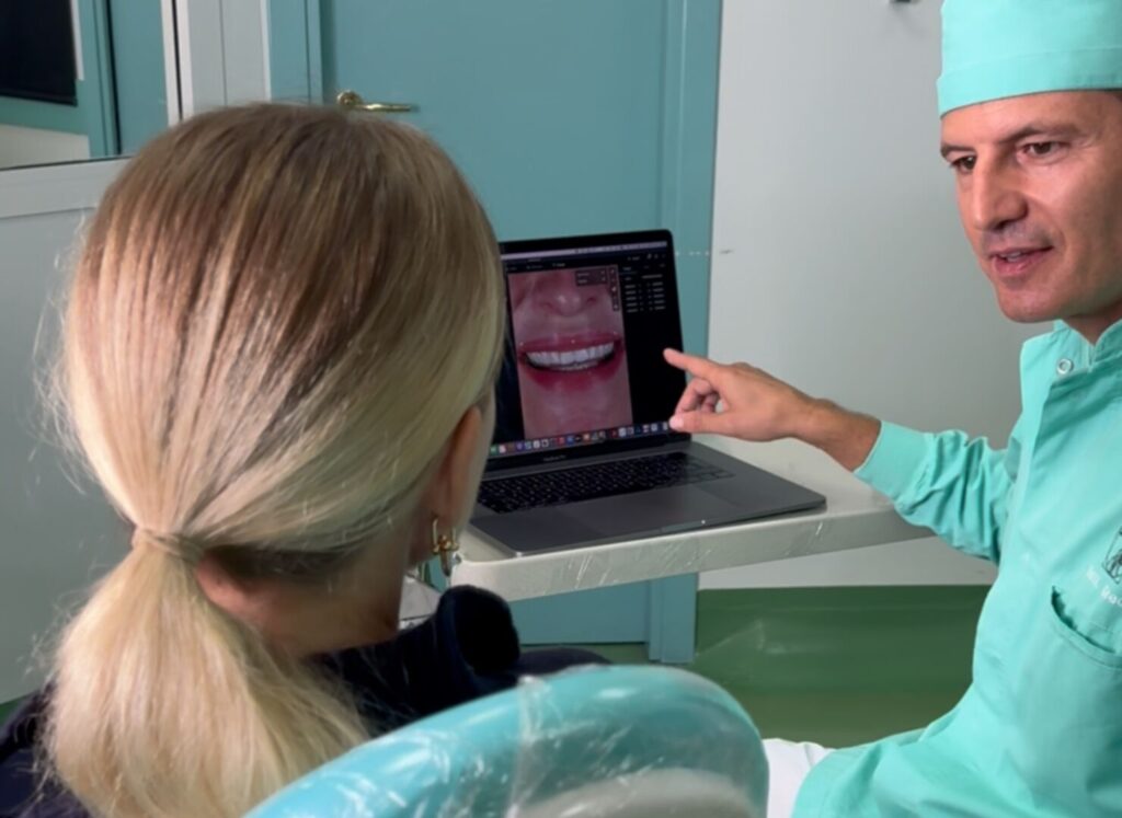 Come cambiano i denti con le faccette dentali